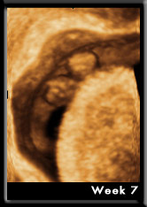 Baby Image at Week7