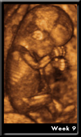 Baby Image at Week9
