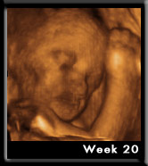 Baby Image at Week20