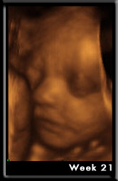 Baby Image at Week21
