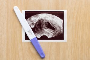 Pregnancy test with ultrasound picture of baby on wooden background. Pregnancy care concept.
